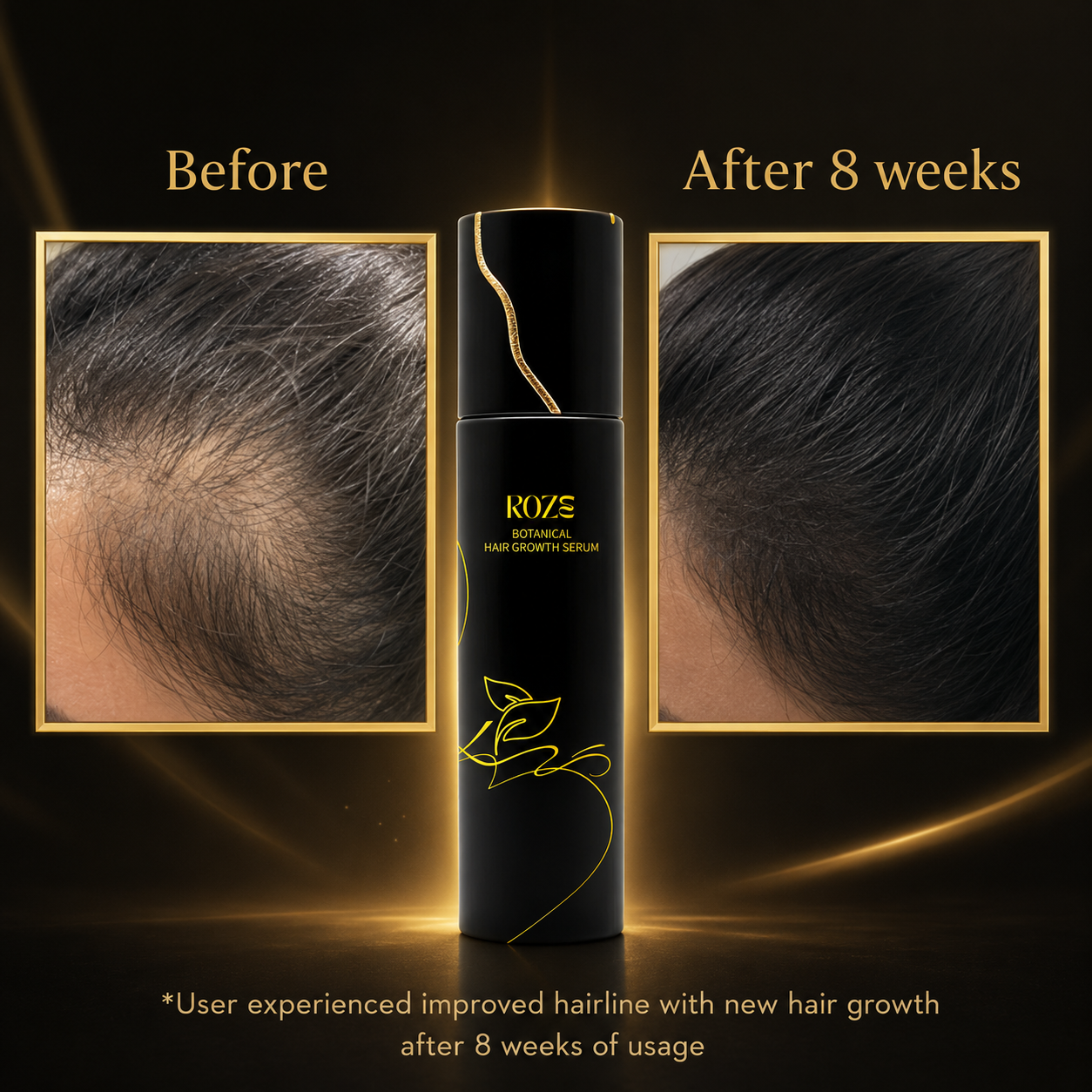 Before and after usage and resukts of roze hair growth serum